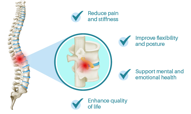 What Is Spondylitis?