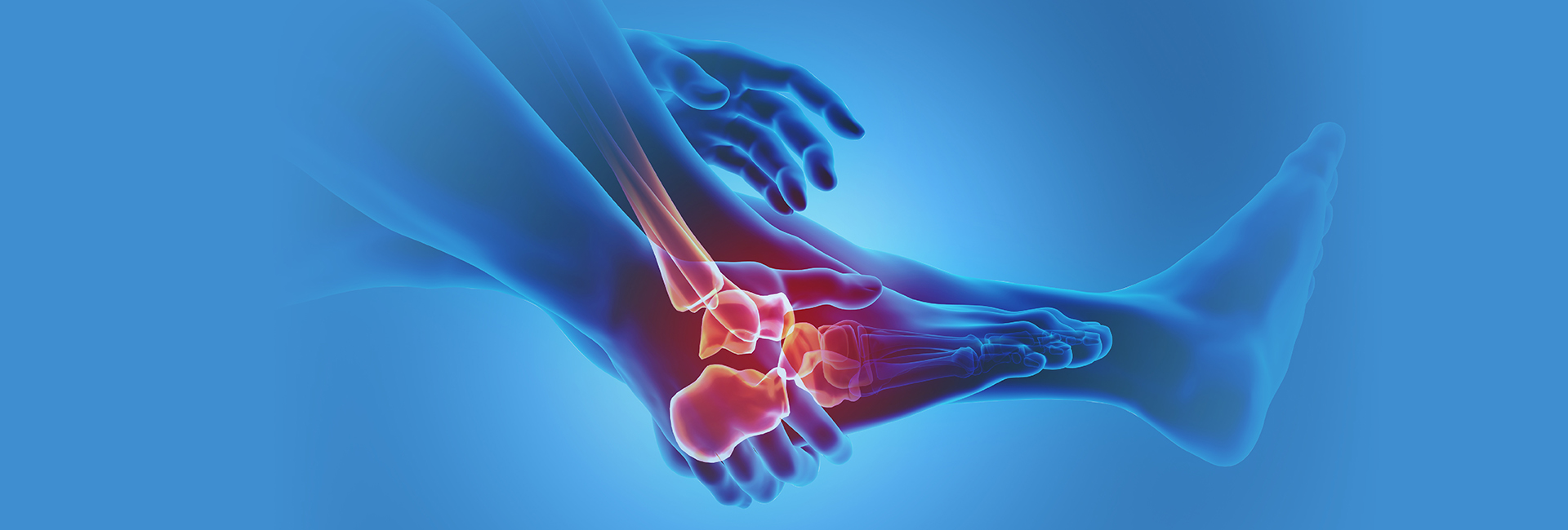 Rheumatoid Arthritis