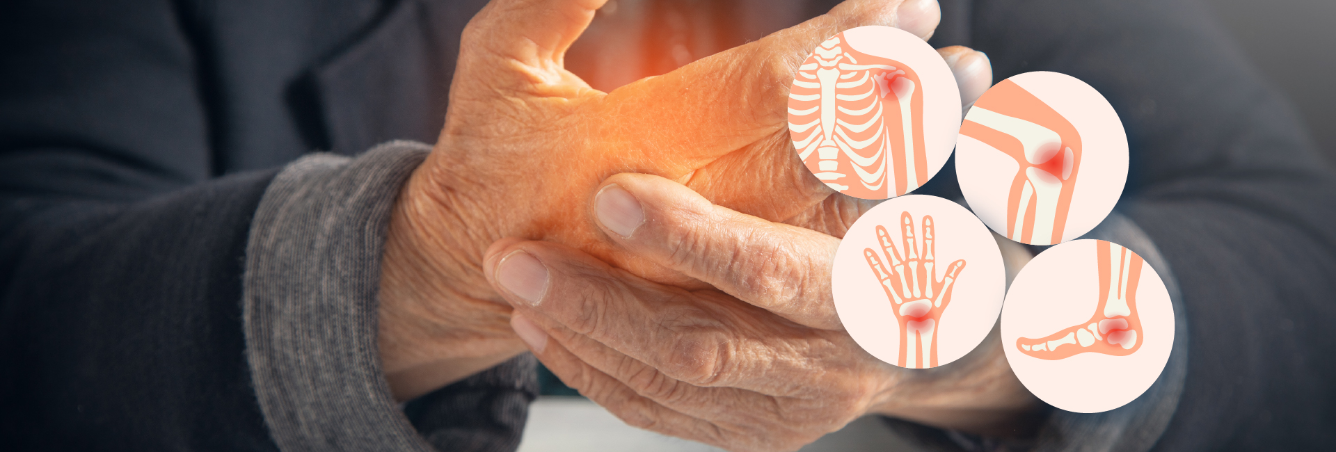 Arthritis Is Not One Condition