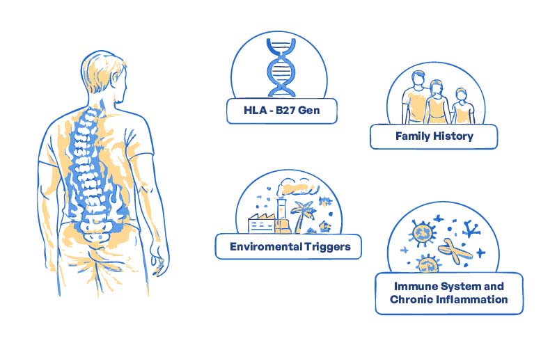 What Causes Ankylosing Spondylitis?