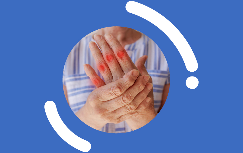 How is Psoriatic Arthritis Diagnosed?