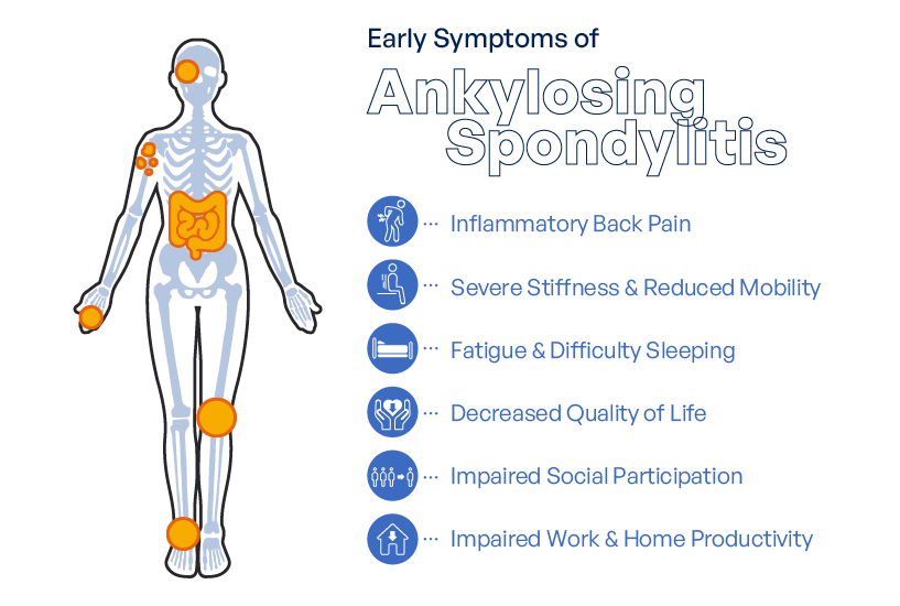 Understanding the Symptoms of Ankylosing Spondylitis
