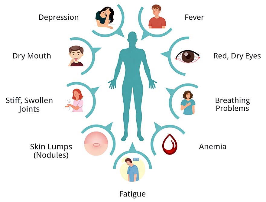Overview of Rheumatoid Arthritis Symptoms