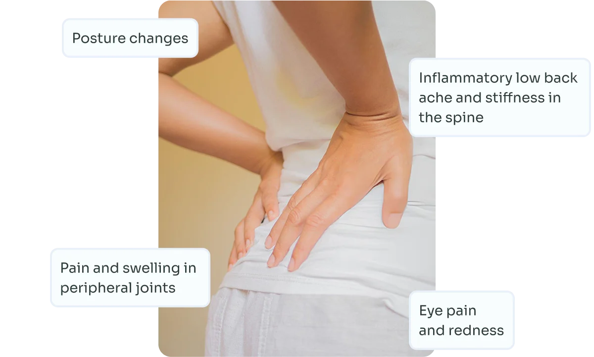 Diagnosis of Rheumatoid Arthritis Symptoms