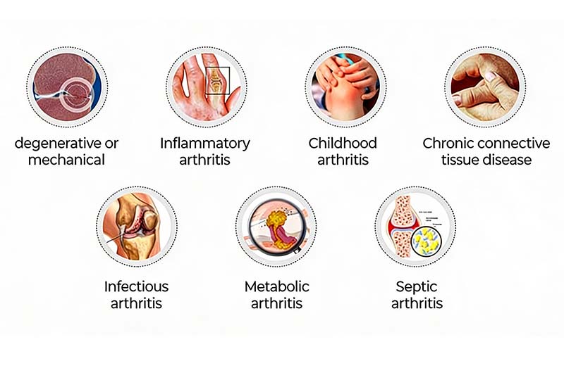 Why Understanding the Type of Arthritis Matters