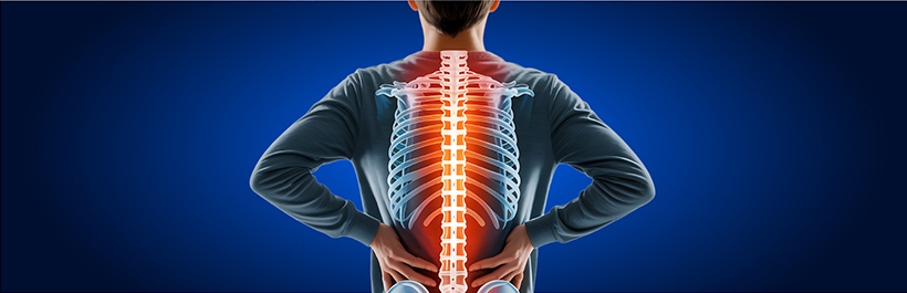 Ankylosing Spondylitis Facts