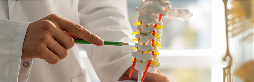 Basics of Ankylosing Spondylitis