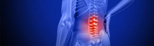 Ankylosing Spondylitis – FAQ