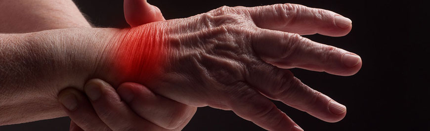 What is Arthritis?