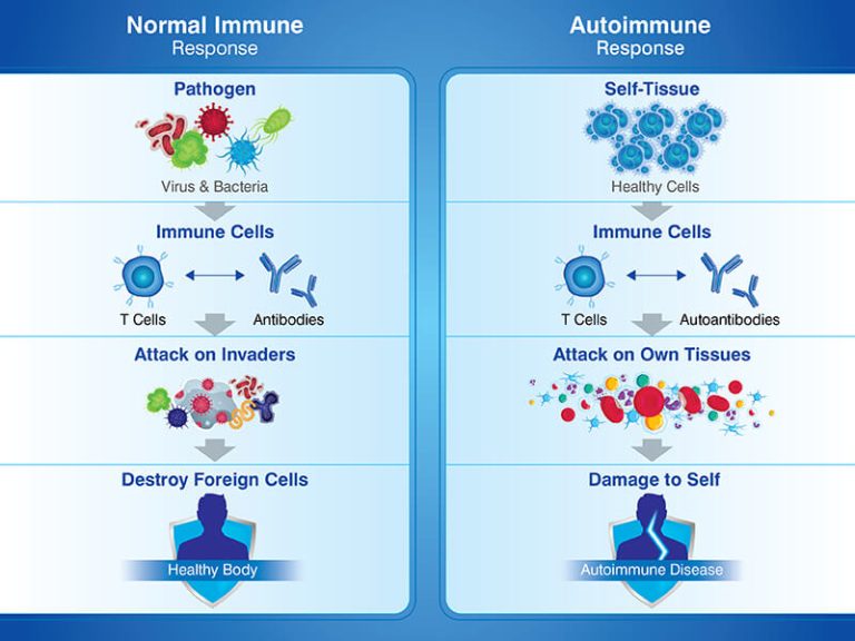 Autoimmune Diseases: Causes, Symptoms, Types & Treatment