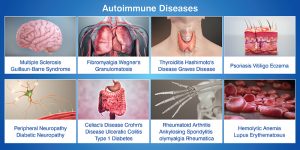 Everything to Know About Autoimmune Diseases
