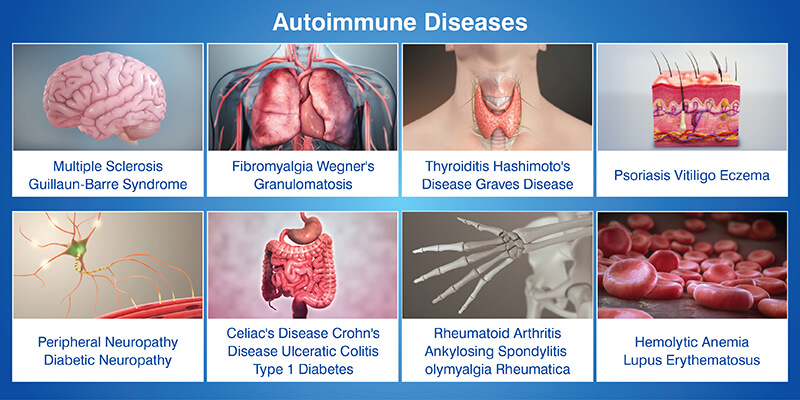 Everything to Know About Autoimmune Diseases