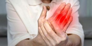 Hormones and Rheumatoid Arthritis Why Women Experience More Flares