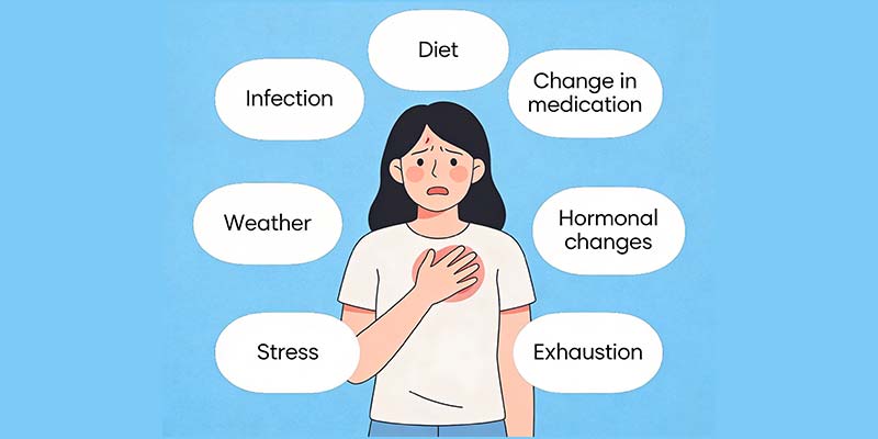 Top Rheumatoid Arthritis Flare Triggers